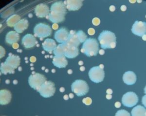 bacteria_on_agar_plate